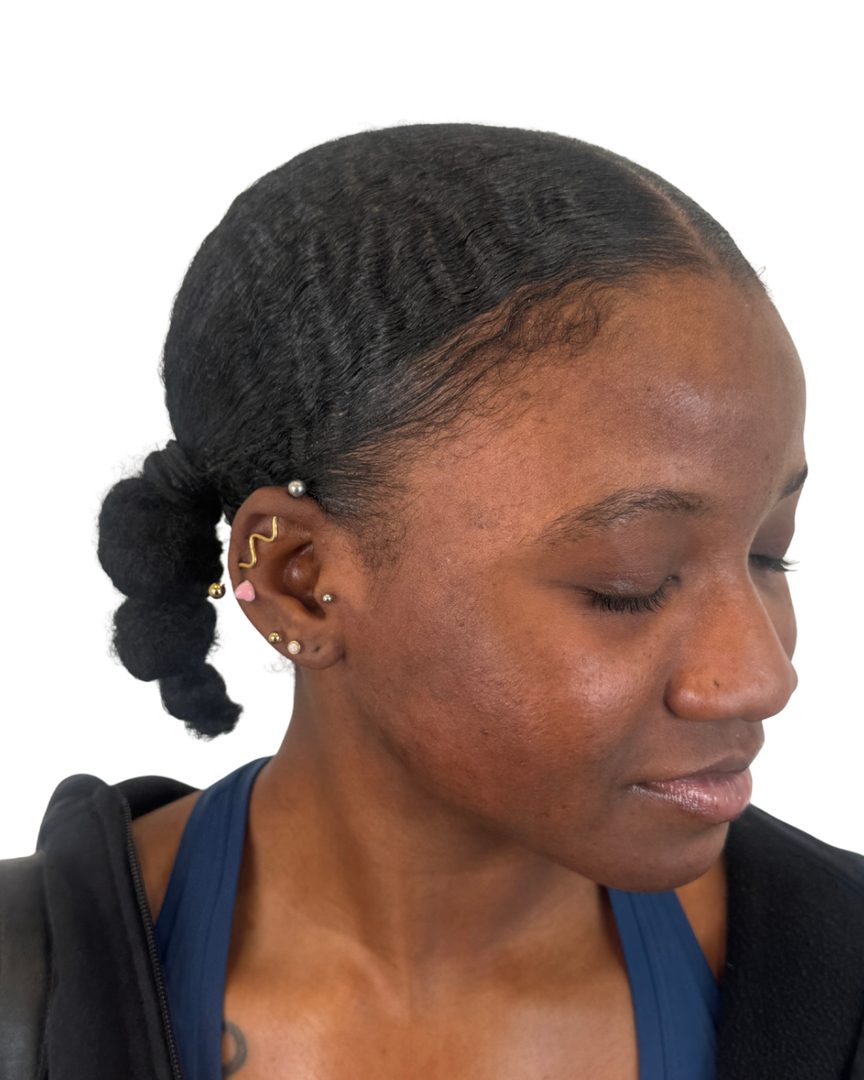 Client 01, face, after treatment