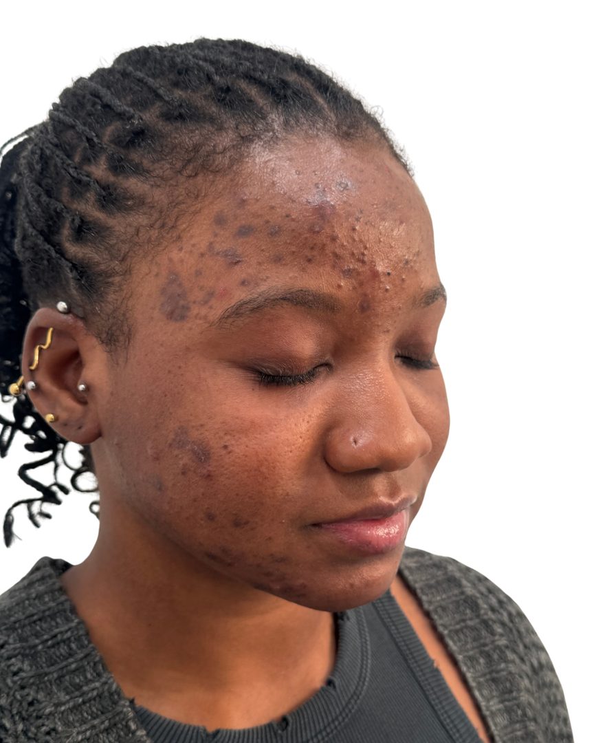 Client 01, face, before treatment