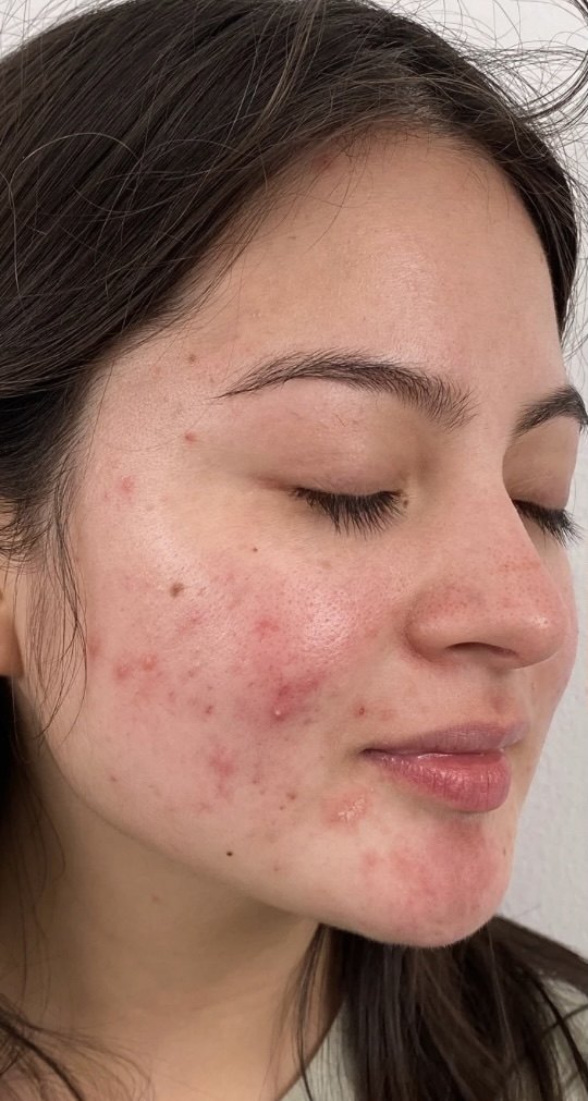 Client 10, face, before treatment