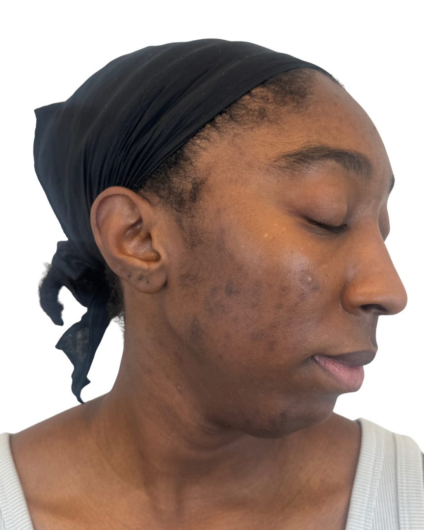 Client 03, face, before treatment