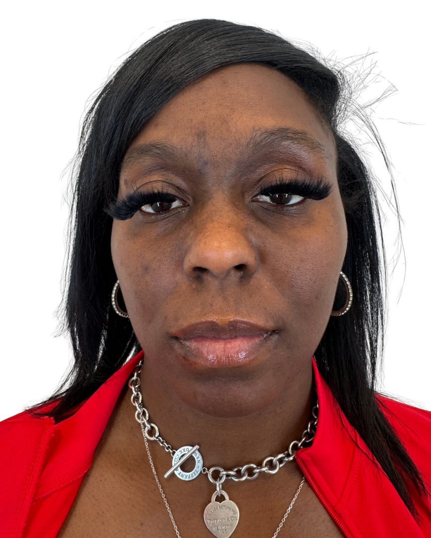 Client 05, face, before treatment