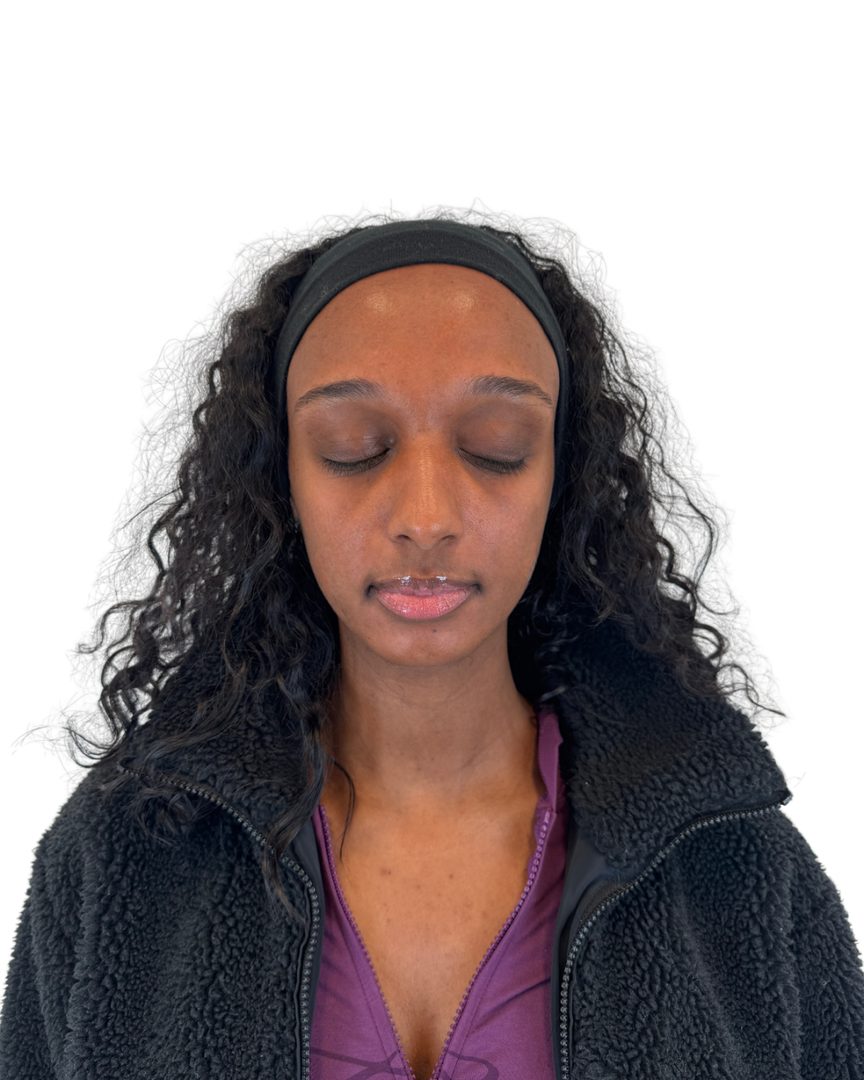 Client 07, face, after treatment