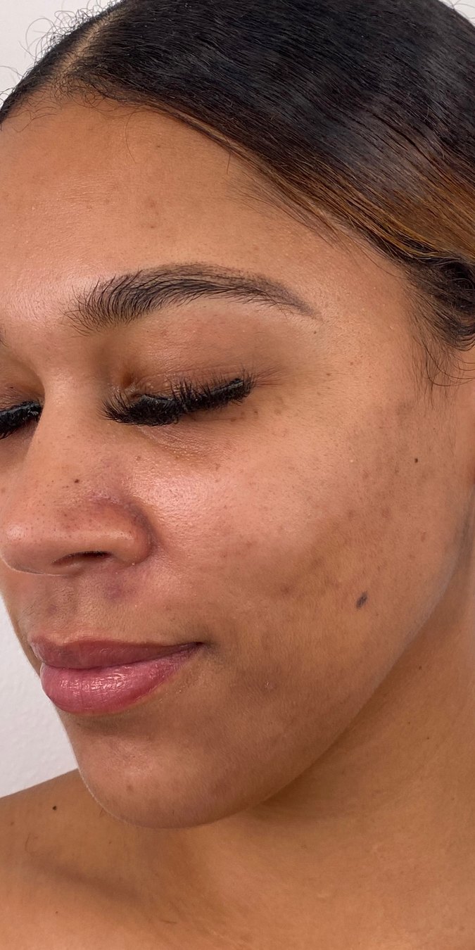 Client 08, face, after treatment
