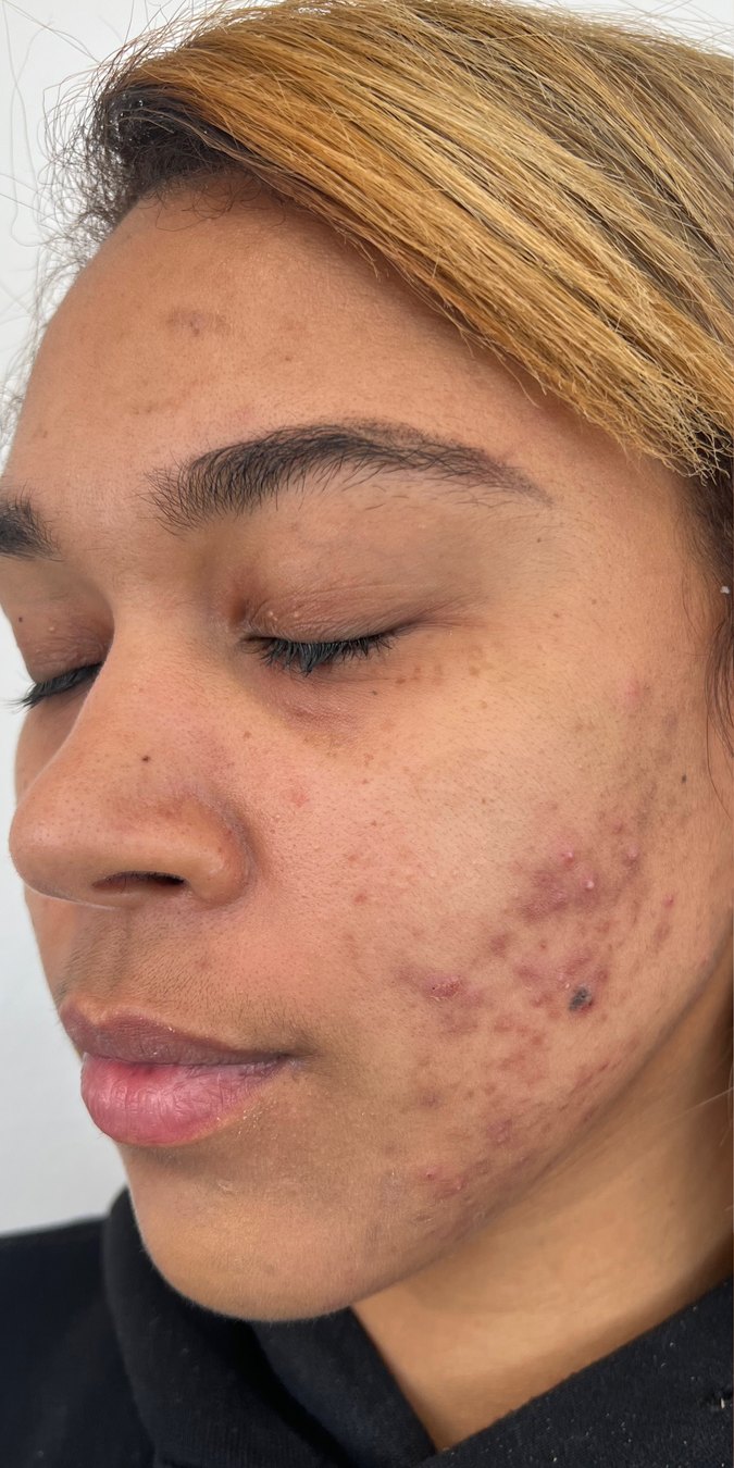 Client 08, face, before treatment