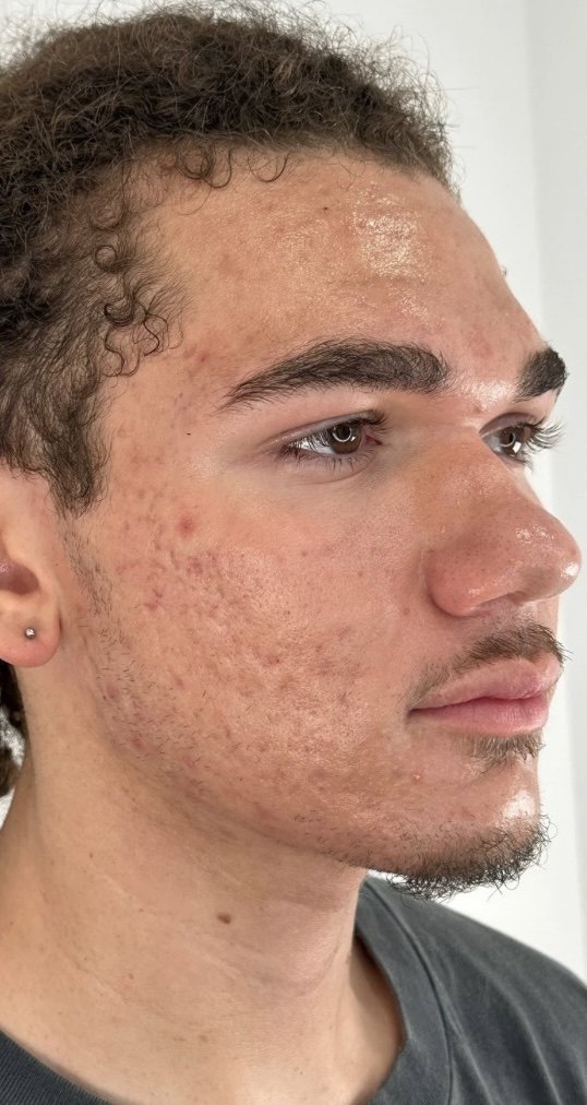 Client 09, face, before treatment
