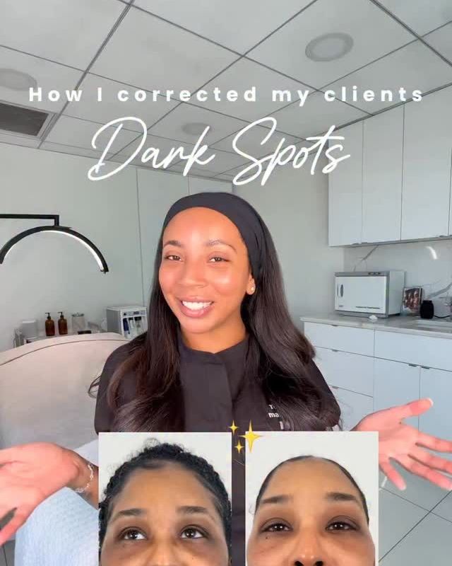 Instagram reel: Correcting dark spots