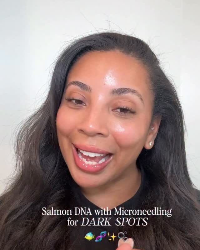Instagram reel: Microneedling + salmon DNA
